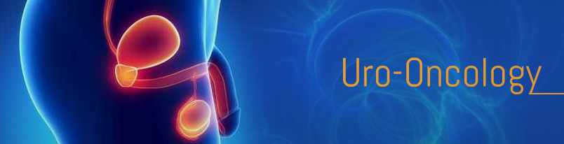 Uro oncology treatment