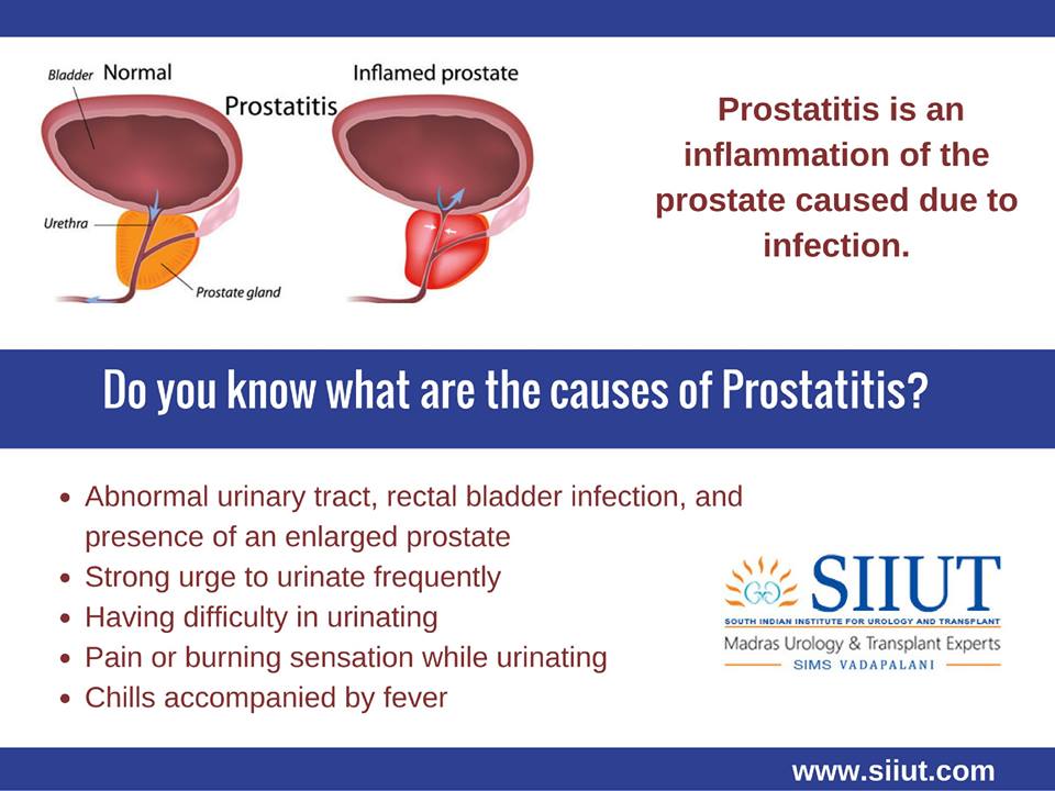 Prostatitis ansteckend für frau symptome